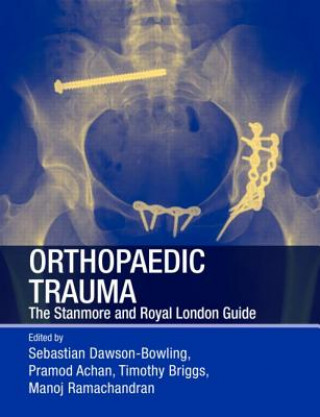 Könyv Orthopaedic Trauma Sebastian Dawson-Bowling