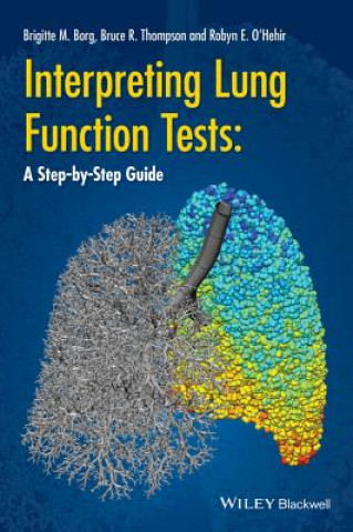 Könyv Interpreting Lung Function Tests - A Step-by-Step Guide Bruce Thompson