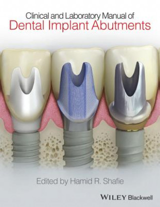 Kniha Clinical and Laboratory Manual of Dental Implant Abutments Hamid R. Shafie