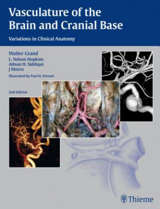 Könyv Vasculature of the Brain and Cranial Base Walter Grand