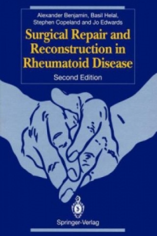 Carte Surgical Repair and Reconstruction in Rheumatoid Disease Alexander Benjamin