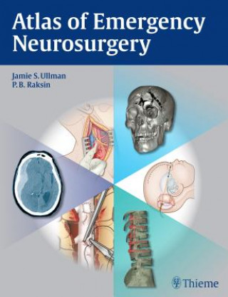 Knjiga Atlas of Emergency Neurosurgery Jamie S. Ullman
