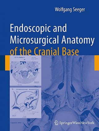 Книга Endoscopic and microsurgical anatomy of the cranial base Wolfgang Seeger