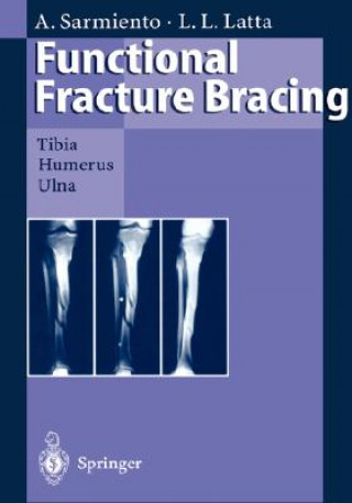 Książka Functional Fracture Bracing Augusto Sarmiento