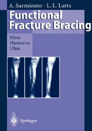 Kniha Functional Fracture Bracing Augusto Sarmiento