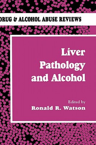 Kniha Liver Pathology and Alcohol Ronald Watson