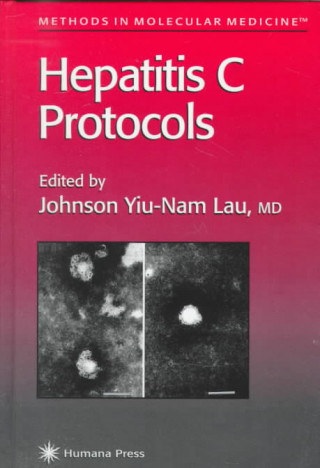 Knjiga Hepatitis C Protocols Johnson Y. N. Lau