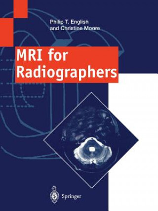 Книга MRI for Radiographers Philip T. English