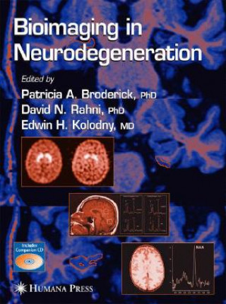 Buch Bioimaging in Neurodegeneration Patricia A. Broderick