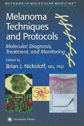 Könyv Melanoma Techniques and Protocols Brian J. Nickoloff