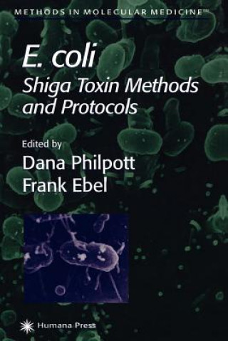 Könyv E. coli Dana Philpott