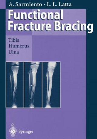 Libro Functional Fracture Bracing Augusto Sarmiento