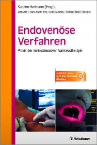 Könyv Endovenöse Verfahren Jens Alm