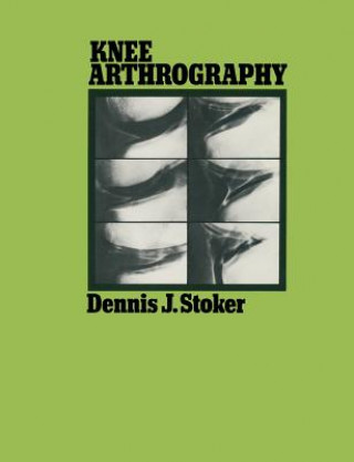 Kniha Knee Arthrography Dennis J. Stoker