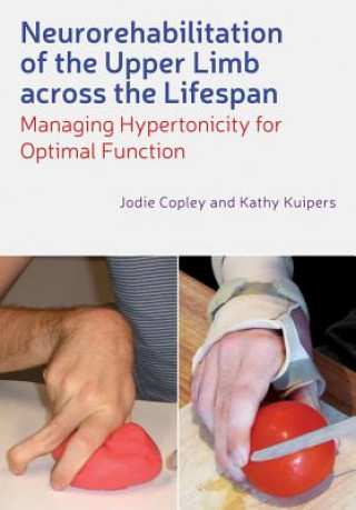 Carte Neurorehabilitation of the Upper Limb Across the Lifespan - Managing Hypertonicity for Optimal Function Jodie Copley