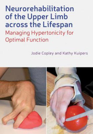 Book Neurorehabilitation of the Upper Limb Across the Lifespan - Managing Hypertonicity for Optimal Function Jodie Copley