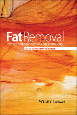 Buch Fat Removal Matthew Avram