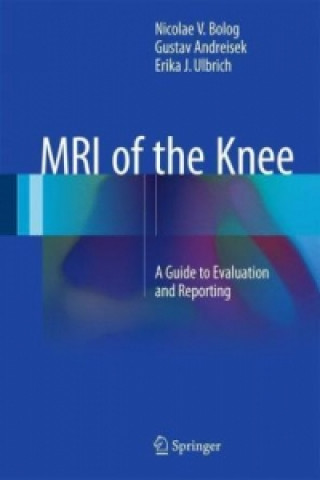 Książka MRI of the Knee Nicolae Bolog