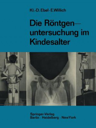 Książka Die R ntgenuntersuchung Im Kindesalter Klaus-Dietrich Ebel