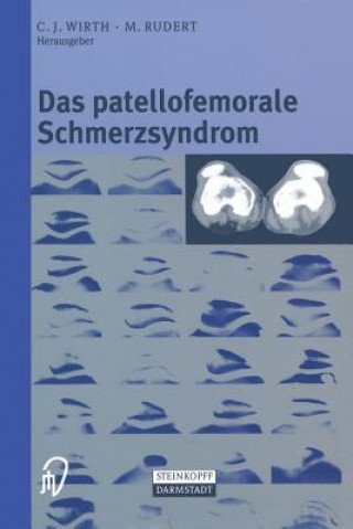 Könyv Das Patellofemorale Schmerzsyndrom C.J. Wirth