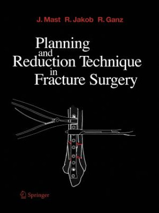 Könyv Planning and Reduction Technique in Fracture Surgery Jeffrey Mast