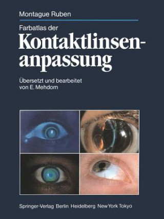 Livre Farbatlas Der Kontaktlinsenanpassung Montague Ruben