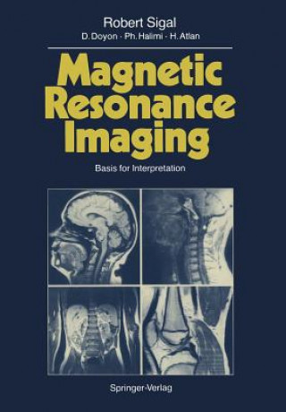 Carte Magnetic Resonance Imaging Robert Sigal