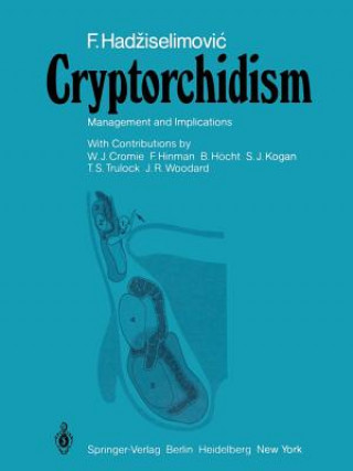 Book Cryptorchidism Faruk Hadziselimovic