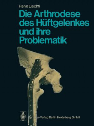 Książka Die Arthrodese Des Huftgelenkes Und Ihre Problematik R. Liechti