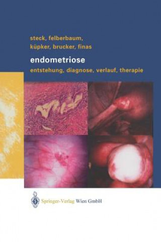 Книга Endometriose Thomas Steck