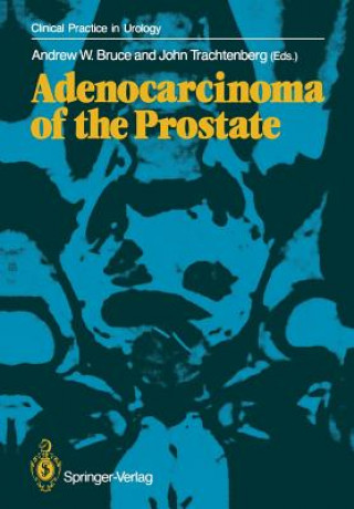 Carte Adenocarcinoma of the Prostate Andrew W. Bruce