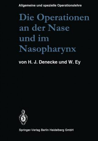 Carte Operationen an Der Nase Und Im Nasopharynx Hans Joachim Denecke