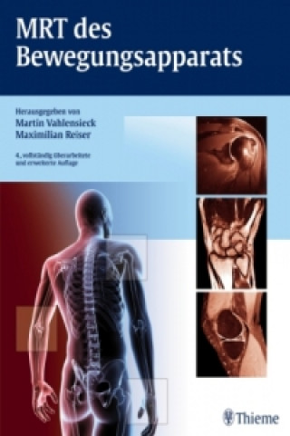 Kniha MRT des Bewegungsapparats Martin Vahlensieck