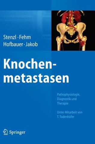 Buch Knochenmetastasen Arnulf Stenzl