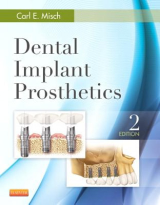 Kniha Dental Implant Prosthetics Carl Misch
