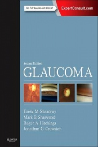 Kniha Glaucoma Tarek Shaarawy