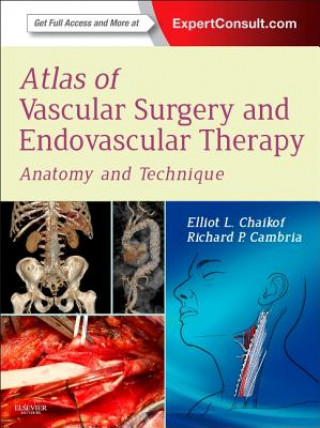 Книга Atlas of Vascular Surgery and Endovascular Therapy Elliot Chaikof