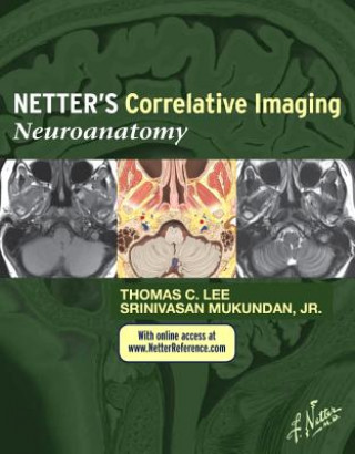 Carte Netter's Correlative Imaging: Neuroanatomy Srinivasan Mukundan