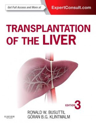 Book Transplantation of the Liver Ronald Busuttil