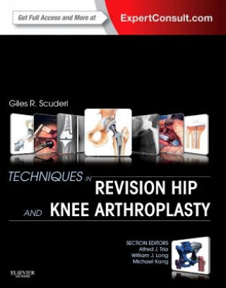 Livre Techniques in Revision Hip and Knee Arthroplasty Giles Scuderi