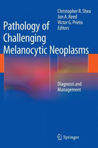 Carte Pathology of Challenging Melanocytic Neoplasms Christopher R. Shea