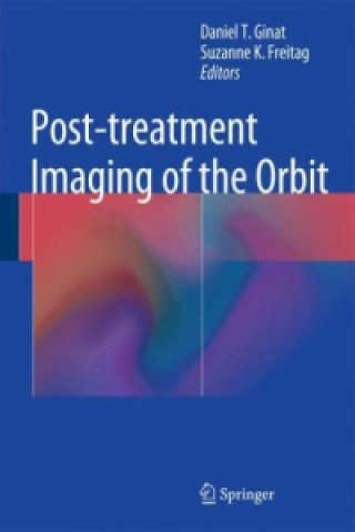 Carte Post-treatment Imaging of the Orbit Daniel Ginat