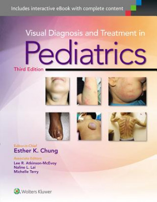 Kniha Visual Diagnosis and Treatment in Pediatrics Esther K Chung
