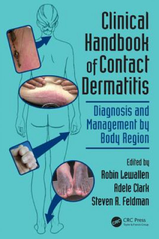 Книга Clinical Handbook of Contact Dermatitis Robin Lewallen