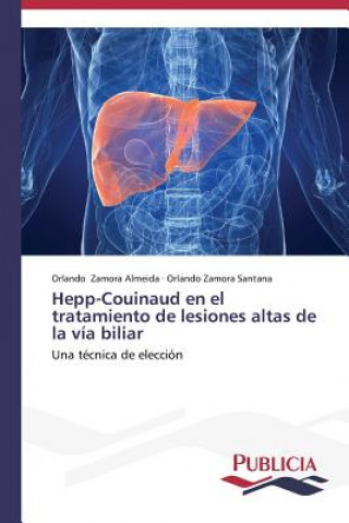 Carte Hepp-Couinaud en el tratamiento de lesiones altas de la via biliar Orlando Zamora Almeida