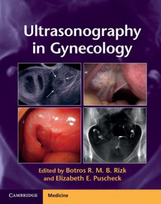 Book Ultrasonography in Gynecology Botros R M B Rizk