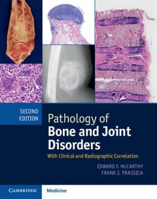 Book Pathology of Bone and Joint Disorders Print and Online Bundle Edward F McCarthy