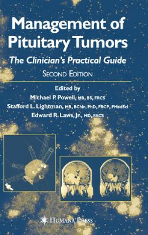 Kniha Management of Pituitary Tumors Michael P. Powell