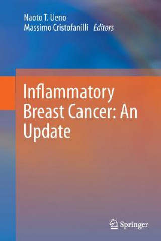 Книга Inflammatory Breast Cancer: An Update Naoto T. Ueno