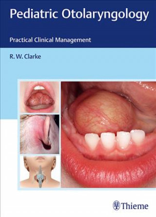 Kniha Pediatric Otolaryngology Raymond Clarke